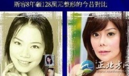 福州整形爆料事件始末视频,真相与争议的漩涡