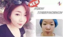 福州整形爆料事件始末视频,真相与争议的漩涡