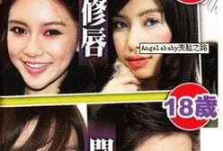 福州整形爆料事件始末视频,真相与争议的漩涡